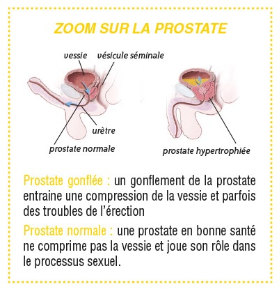 Prostate Prostate